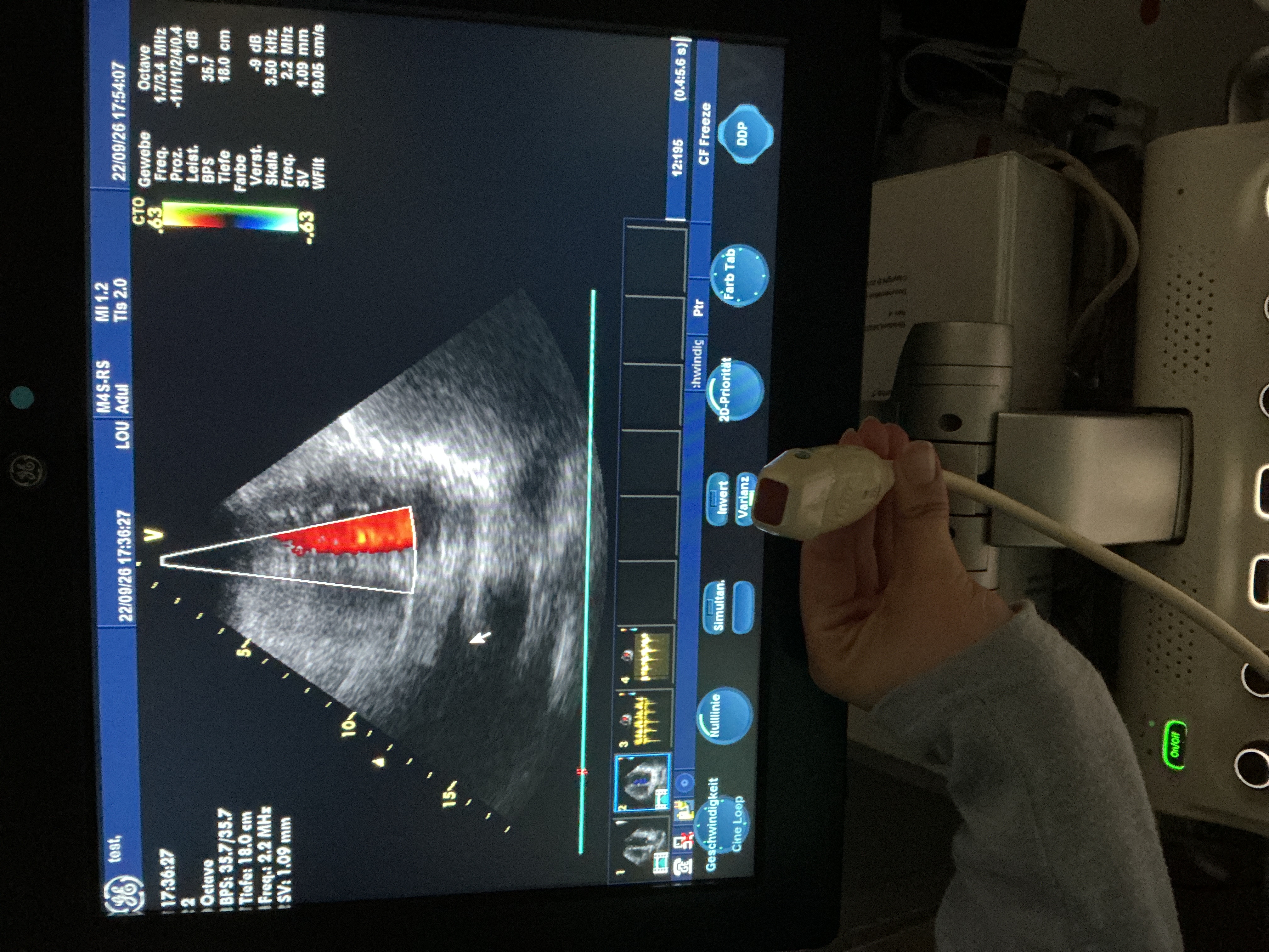 Gebraucht GE 10S-RS Kardio Ultraschallsonde
