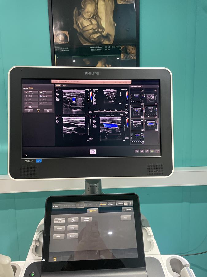 Gebraucht Philips Epiq 5G Ultraschallgerät mit drei Sonden