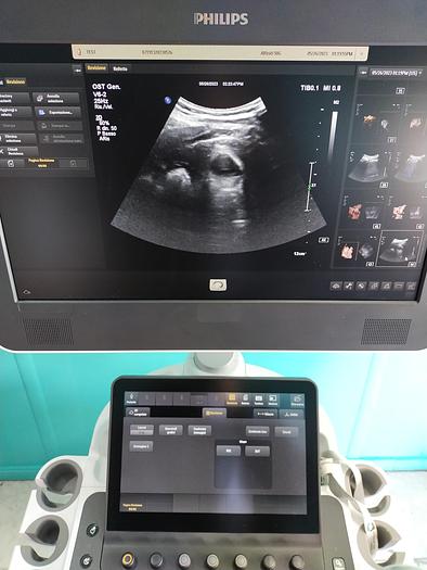 Gebraucht Philips V6-2  3D/4D  Volumen Ultraschallsonde