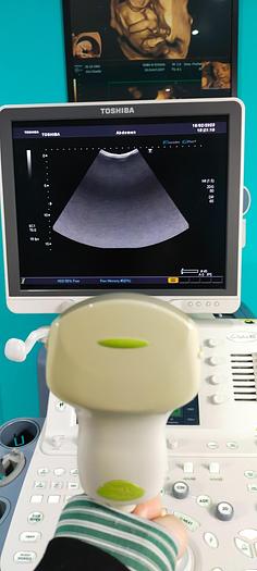 Gebraucht Toshiba aplio XG SSA-790A Ultraschallgerät mit 3 Sonden