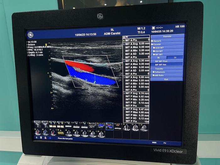 Gebraucht GE Vivid E9 XDclear Ultraschallgerät mit zwei Sonden und Drucker