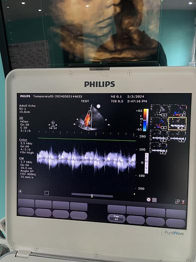 Gebraucht Philips CX50 Purewave Ultraschallgerät mit kardio Sonde