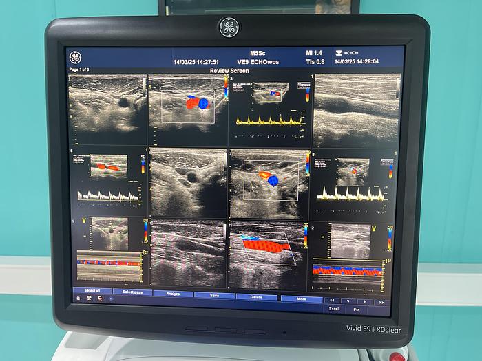 Gebraucht GE Vivid E9 XDclear Ultraschallgerät mit zwei Sonden #2015 