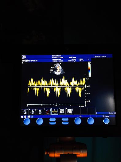 Gebraucht GE  Vivid S5  Ultraschallgerät auf Trolley mit 2 Sonden und EKG Kabel