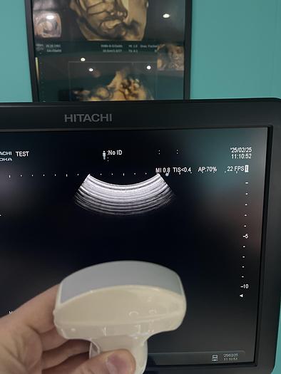 Gebraucht Hitachi ALOKA Arietta V70 Ultraschallgerät mit zwei Sonden und Fußschalter