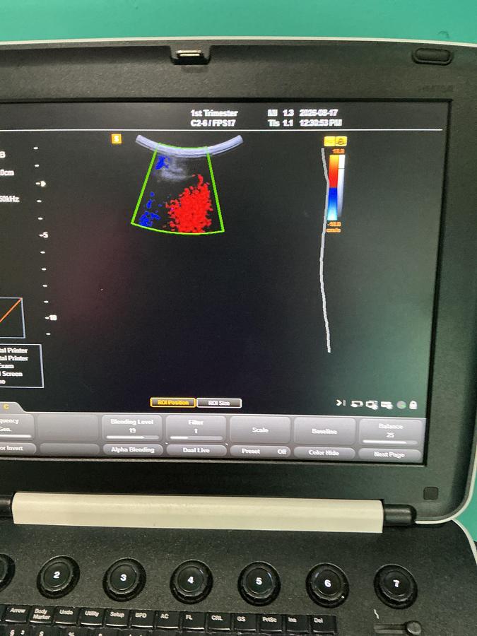 Gebraucht Samsung Medison HM7AF1B Ultraschallgerät mit zwei Sonden