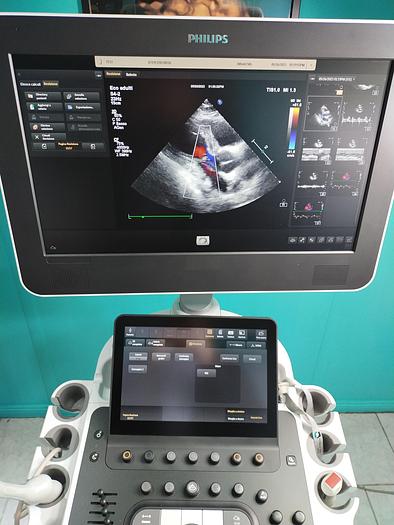 Gebraucht Philips ultrasound Probe S4-2