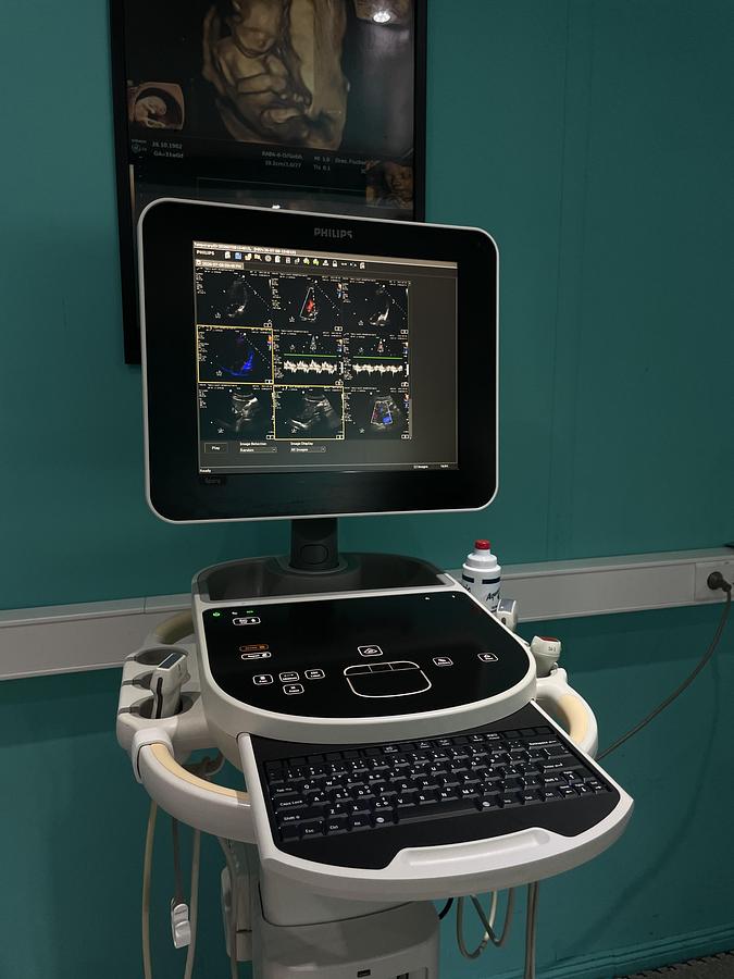 Gebraucht Philips Sparq Ultraschallgerät mit drei Sonden und Drucker