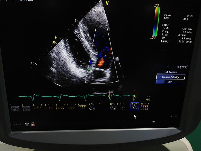 Gebraucht GE Vivid 7 Ultraschallgerät