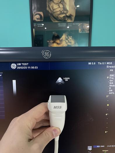Gebraucht GE LOGIQ E9 Ultraschallgerät mit 2 Sonden und Drucker 