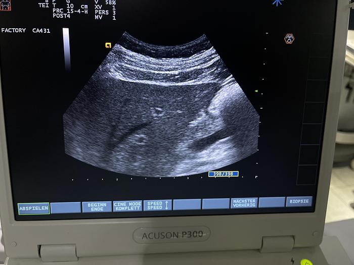 Used Esaote CA431 Konvex Ultraschallsonde