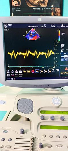 Gebraucht GE Vivid 7 Ultraschallgerät