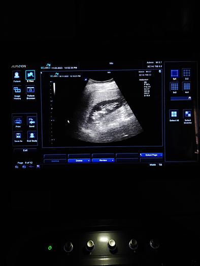 Gebraucht Alpinion E cube 9 Ultraschallgerät SW 2.6 mit 2 Sonde