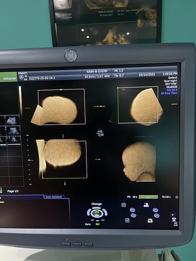 Gebraucht GE 3D/4D RAB4-8-D Ultraschallsonde