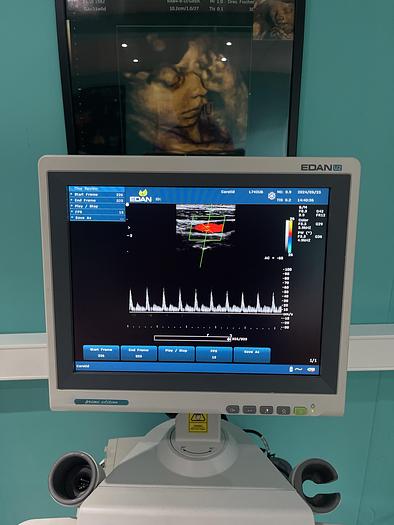 Used EDAN U2 Ultraschallgerät mit drei Sonden und Drucker