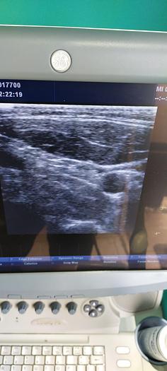 Gebraucht GE 10L Linear Ultraschallsonde