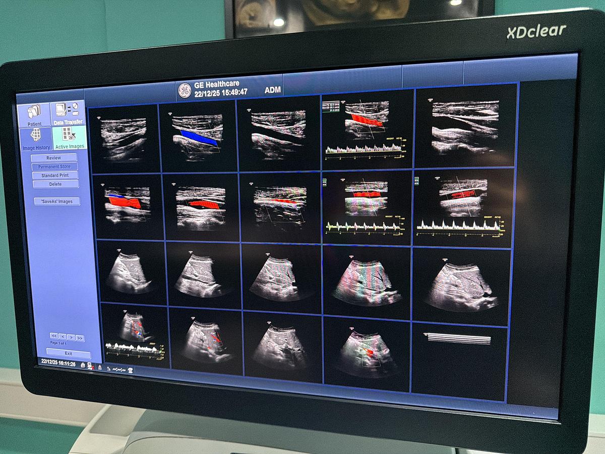 Gebraucht GE LOGIQ E9 XDClear Elastography Ultraschallgerät mit zwei Sonden  