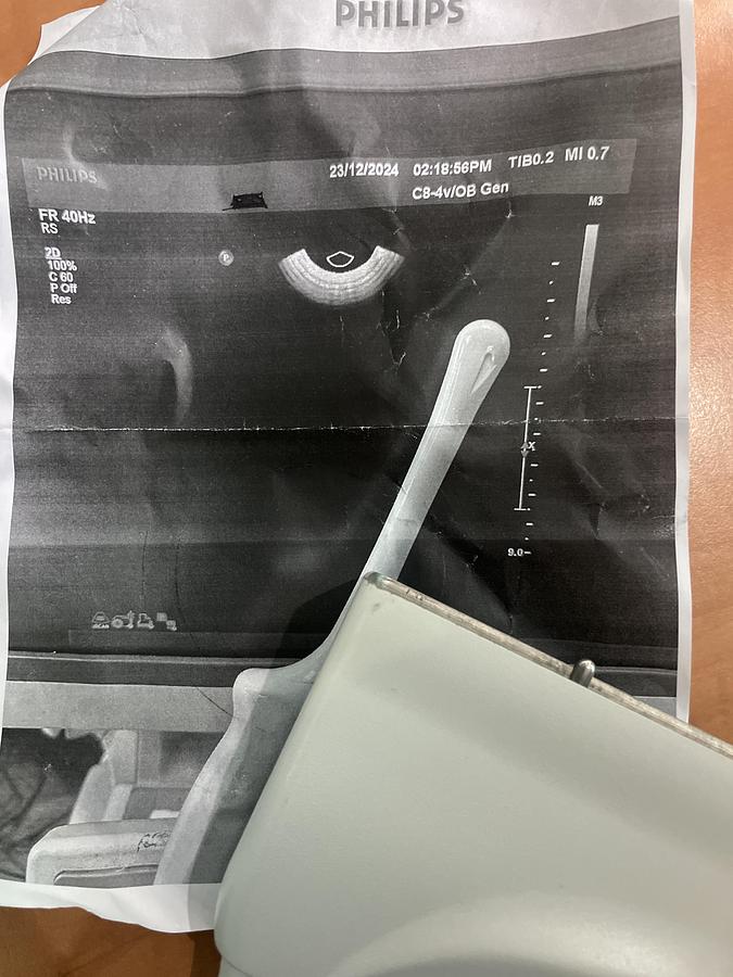 Gebraucht Philips C8-4v Endovaginal Ultraschallsonde