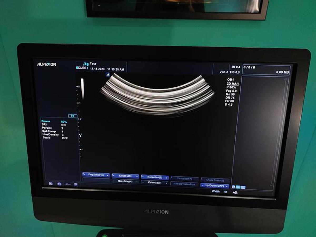 Gebraucht Alpinion SVC1-6 3D/4D Ultraschallsonde