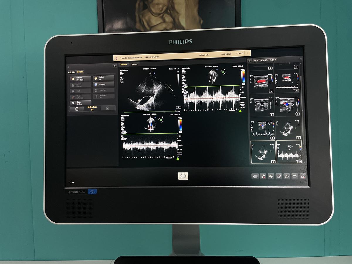 Gebraucht Philips Affiniti 50G Ultraschallgerät mit zwei Sonden