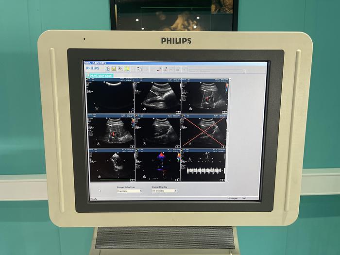 Used Philips HD 11 XE  Ultraschallgerät mit drei Sonden und Drucker