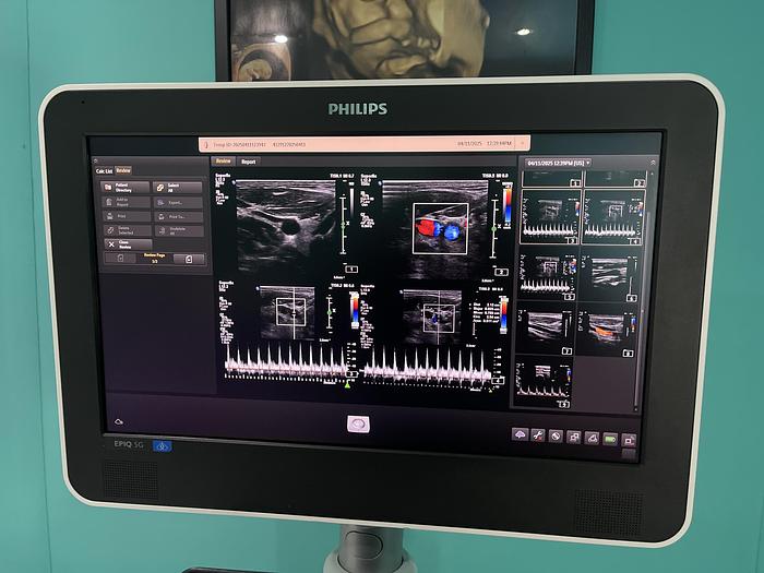 Gebraucht Philips EPIQ 5G Ultraschallgerät 