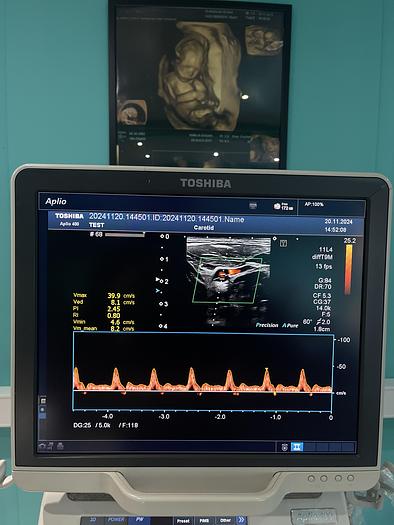 Used Toshiba Aplio 400 Ultraschallgerät mit 2 Sonden