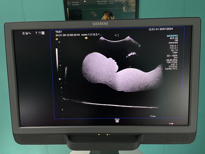 Gebraucht HELX Evoulution Acusion S2000 von Siemens Ultraschall Gerät mit drei Sonden