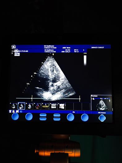 Gebraucht GE  Vivid S5  Ultraschallgerät auf Trolley mit 2 Sonden und EKG Kabel