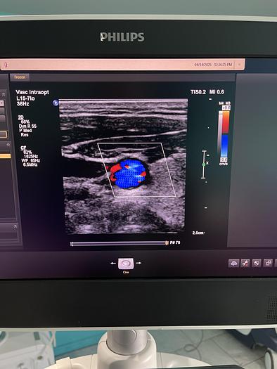 Gebraucht Philips L15-7io Linear Ultraschallsonde