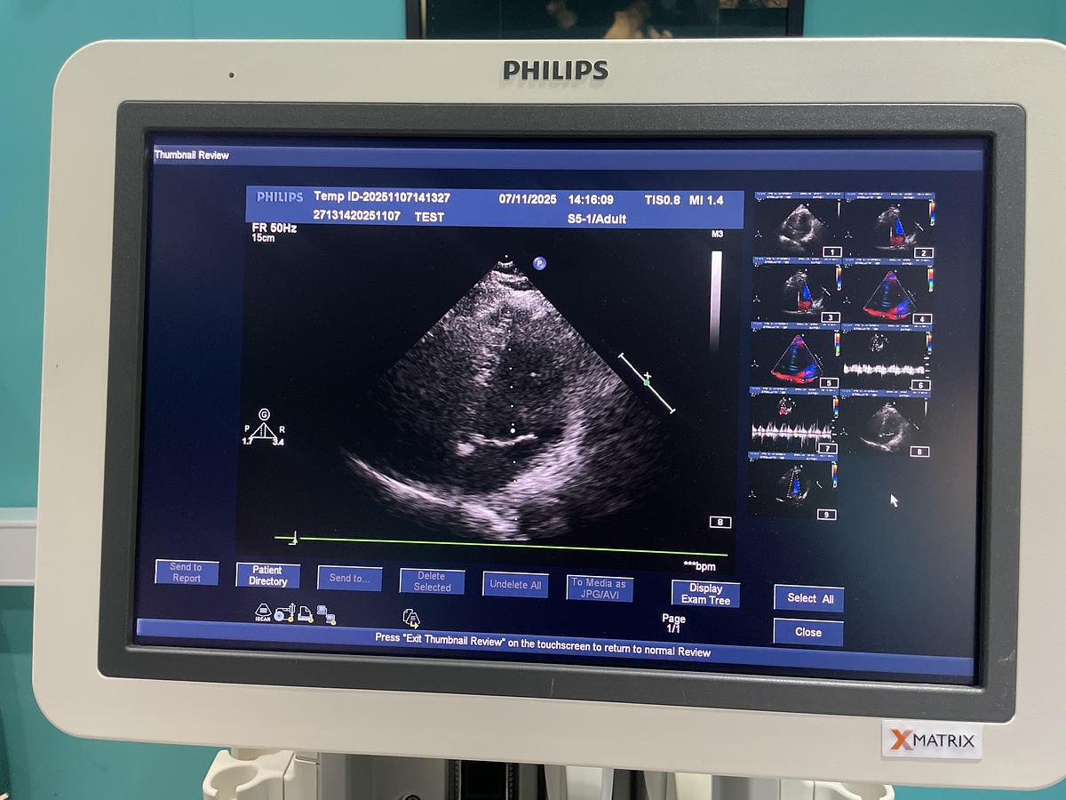 Gebraucht Philips iE33 HW G.1  xMatrix Ultraschallgerät mit S5-1 Kardiosonde und Drucker