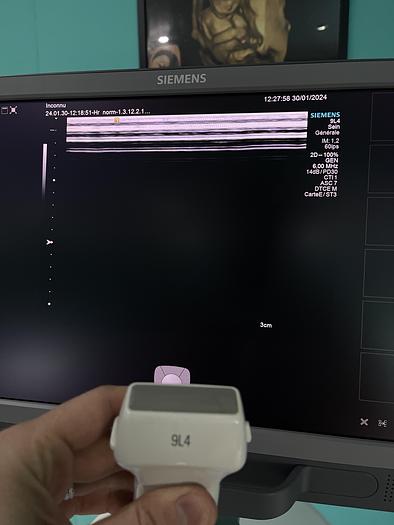 Gebraucht HELX Evoulution Acusion S2000 von Siemens Ultraschall Gerät mit drei Sonden