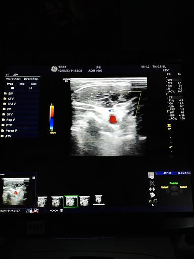 Gebraucht GE LOGIQ E9 Flachbildschirm-Ultraschallgerät inkl. 1 Sonde, Drucker und DVD-Brenner