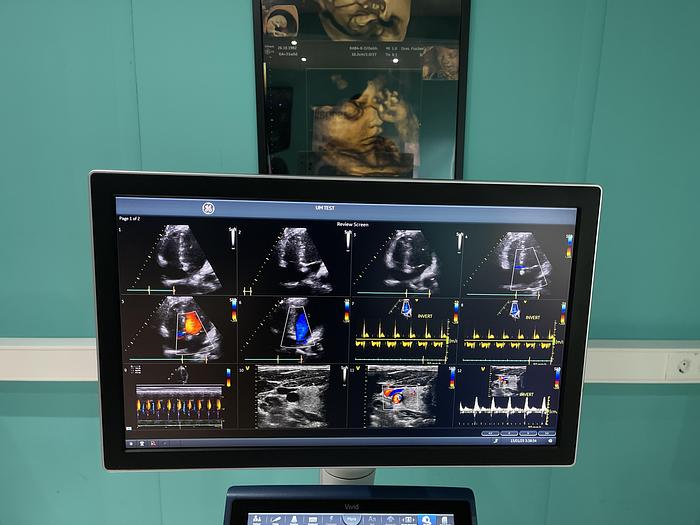 Gebraucht GE VIVID S60N Ultraschallgerät mit zwei Sonden