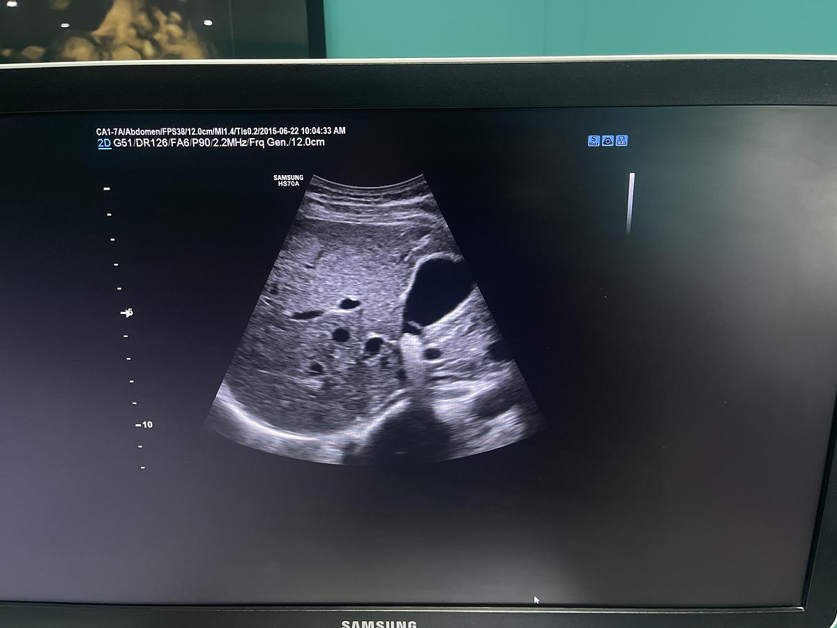 Gebraucht Samsung HS70A Ultraschallgerät mit drei Sonden