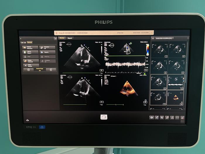 Used Philips X5-1 Sektor Ultraschallsonde