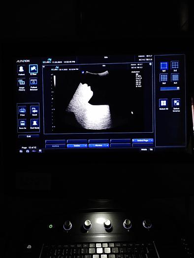 Gebraucht Alpinion E cube 9 Ultraschallgerät SW 2.6 mit 2 Sonde