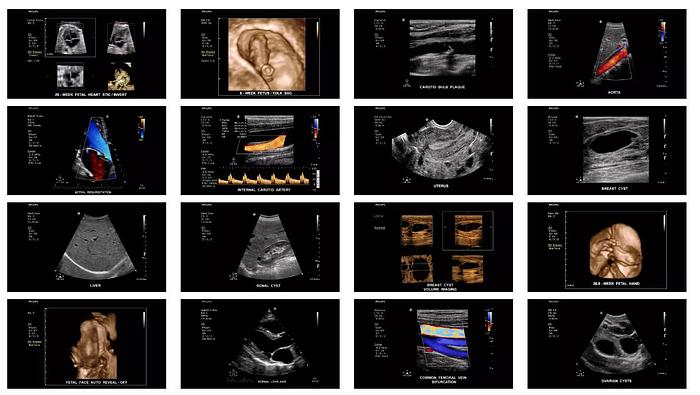 Philips ClearVue 650 Ultraschallsystem