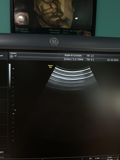 Used GE Voluson E8 Ultraschallgerät mit zwei Sonden und Drucker