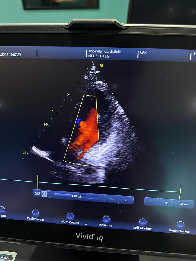 Gebraucht GE M5Sc-RS Kardio Ultraschallsonde