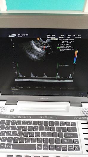 Gebraucht Samsung Ultraschal