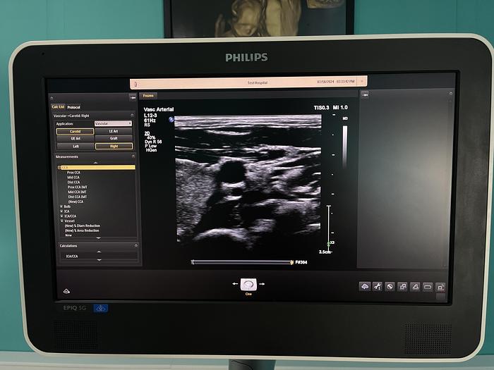 Used Philips EPIQ 5G Ultraschallgerät mit zwei Sonden