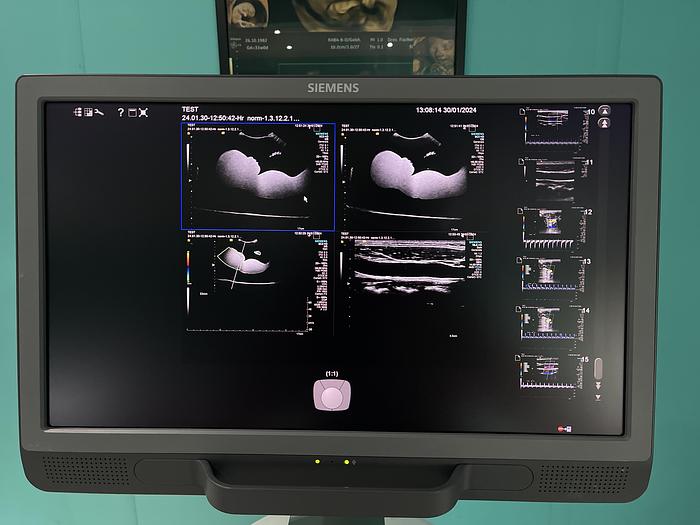 Gebraucht HELX Evoulution Acusion S2000 von Siemens Ultraschall Gerät mit drei Sonden