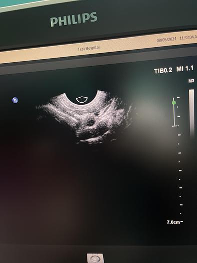 Used Philips C10-4ec Endo Vaginal Ultraschallsonde