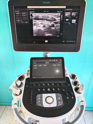 Gebraucht Philips  Affiniti 70G Screen Ultrasound Scanner 