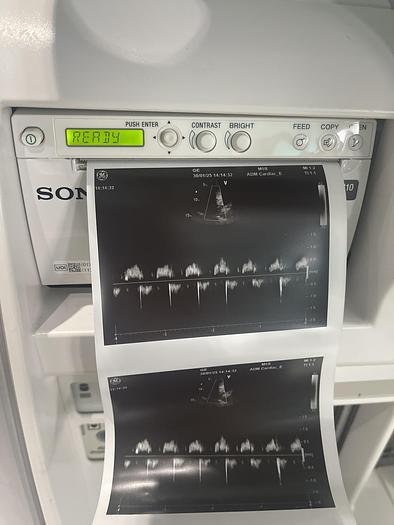 Gebraucht GE Vivid E9 Ultraschallgerät mit Kardiosonde und Drucker