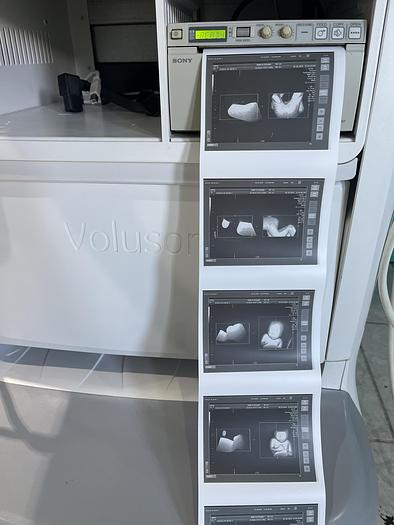 Used GE Voluson E8 Ultraschallgerät mit zwei Sonden und Drucker