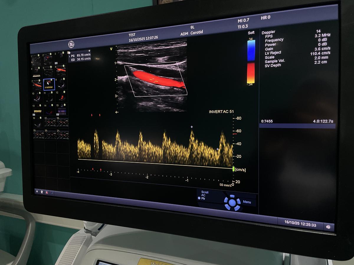 Gebraucht GE Vivid E95 v202 Ultraschallgerät mit zwei Sonden