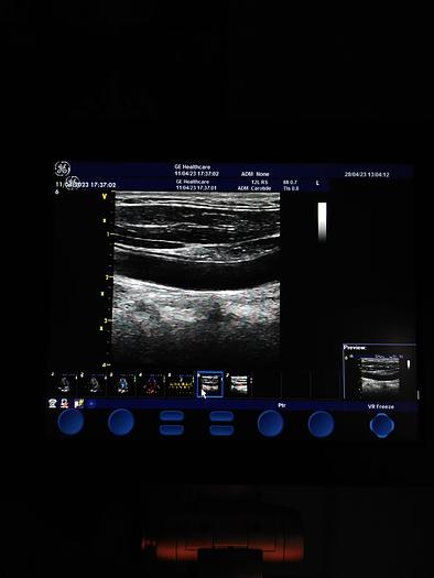 Gebraucht GE  Vivid S5  Ultraschallgerät auf Trolley mit 2 Sonden und EKG Kabel