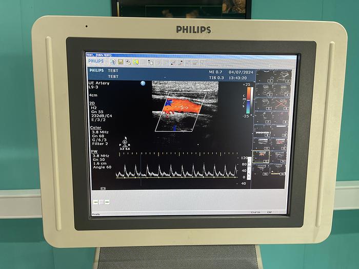 Used Philips HD 11 XE  Ultraschallgerät mit drei Sonden und Drucker